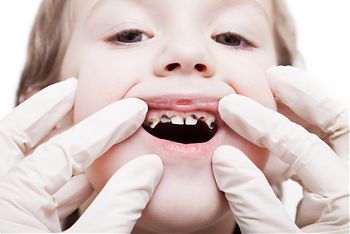 Childrens dentist Cork